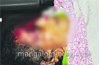 Belthangady: Woman dead, 3 injured in car-lorry collision